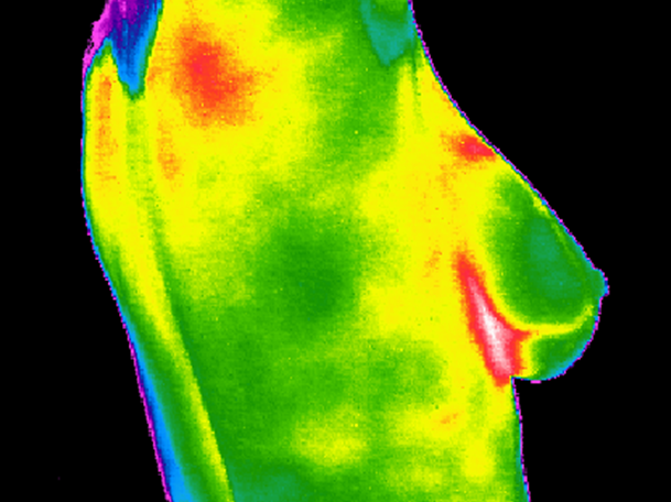 Zdjęcie piersi z kamer termowizyjnych - co dzieje się w przypadku za ciasnego biustonosza
